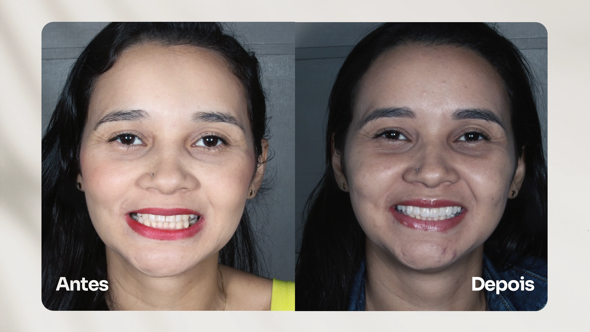 ANTES-E-DEPOIS-4.webp